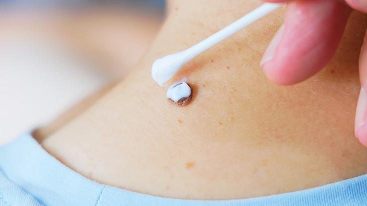 lazerle aldiran da var solusyon suren de her ben masum degil incelenmeli DzdO9kzi.jpg